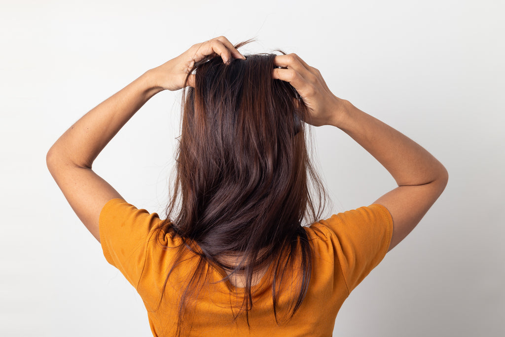 WHAT ARE THE NATURAL REMEDIES FOR DANDRUFF AND DANDRUFF TREATMENT OPTIONS AT HOME?